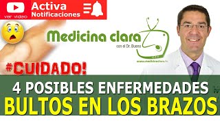 BULTOS en BRAZOS. 4 Enfermedades posibles ¿Cuándo es peligroso | Medicina Clara