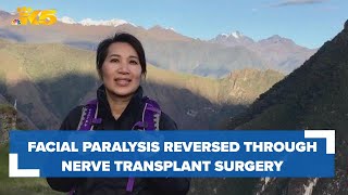 Facial paralysis reversed through nerve transplant surgery: HealthLink