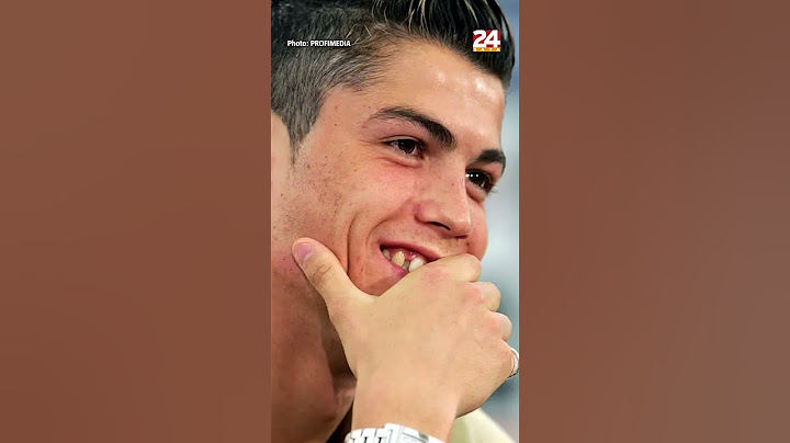 Kakve je zube Ronaldo imao prije operacija? 'To je bilo grozno' | CELEBRITY KLINIKA