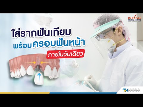 ใส่รากเทียม พร้อมครอบฟันหน้า ภายในวันเดียว |   