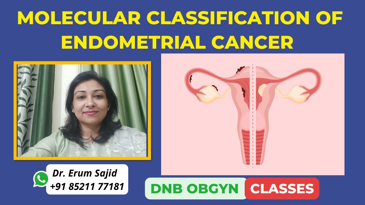 Molecular Classification of Endometrial Cancer| DNB Theory Class | DNB ...