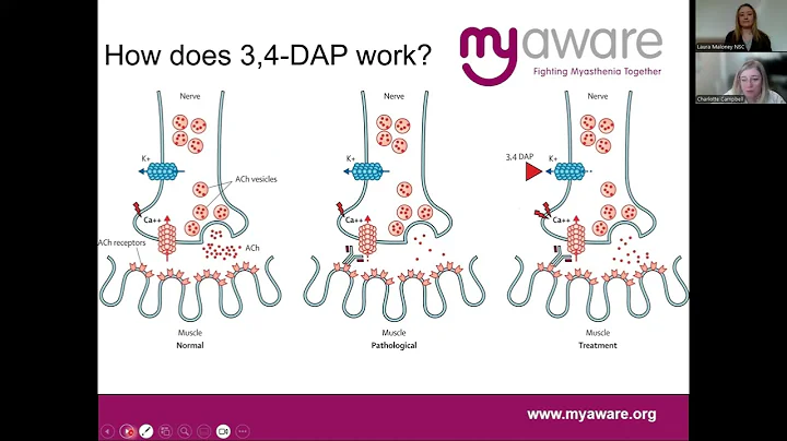 An overview of Lambert-Eaton myasthenic syndrome (LEMS)