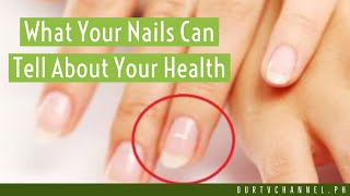 What Your Nails Can Tell About Your Health