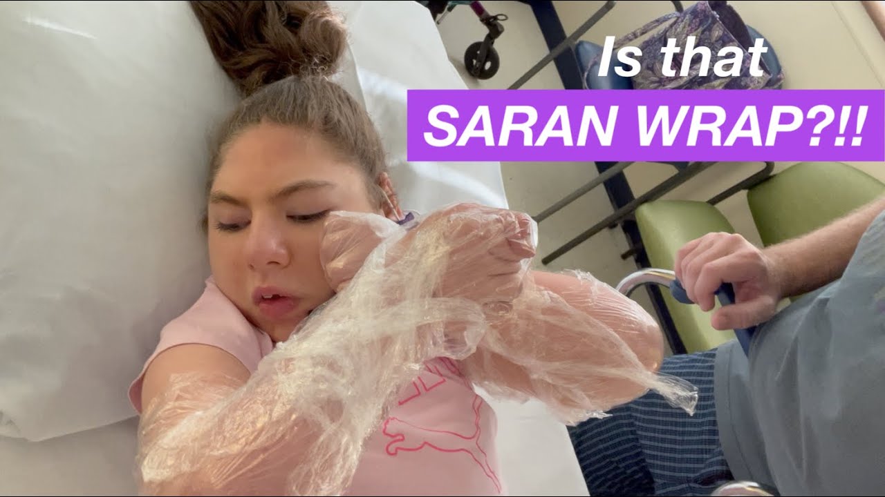 What IS THAT On Her ARMS?!!