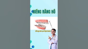 Hình ảnh quá trình Niềng Răng Hô #drcuong #shorts #niengrang