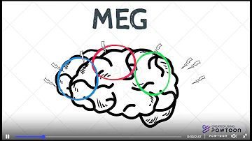 A cosa serve Magnetoencefalografia?