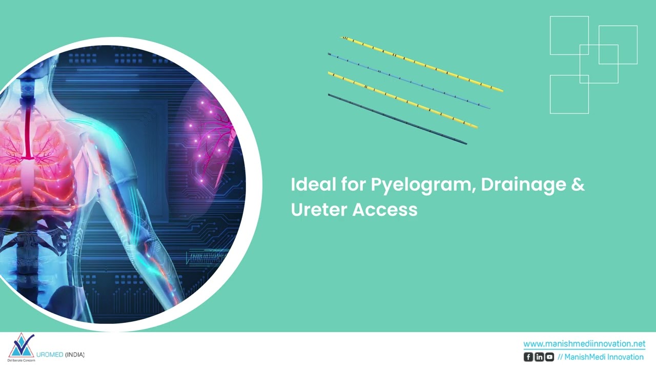 Ureteric Catheter  | Hospital equipment | Surgical Instruments Manufacturer In India