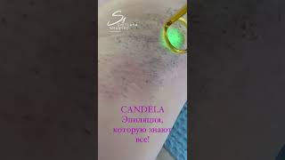 Александритовая эпиляция на CANDELA