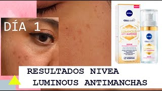 A Prueba La Eficacia De Nivea Luminous 630 Antimanchas Aquí Los Resultados Del Primer Mes