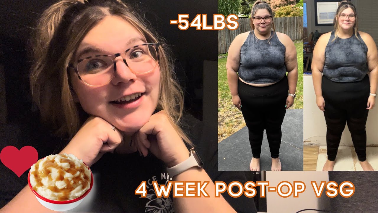 4 Week Post-Op VSG Update | My300lbLife | Photos - YouTube