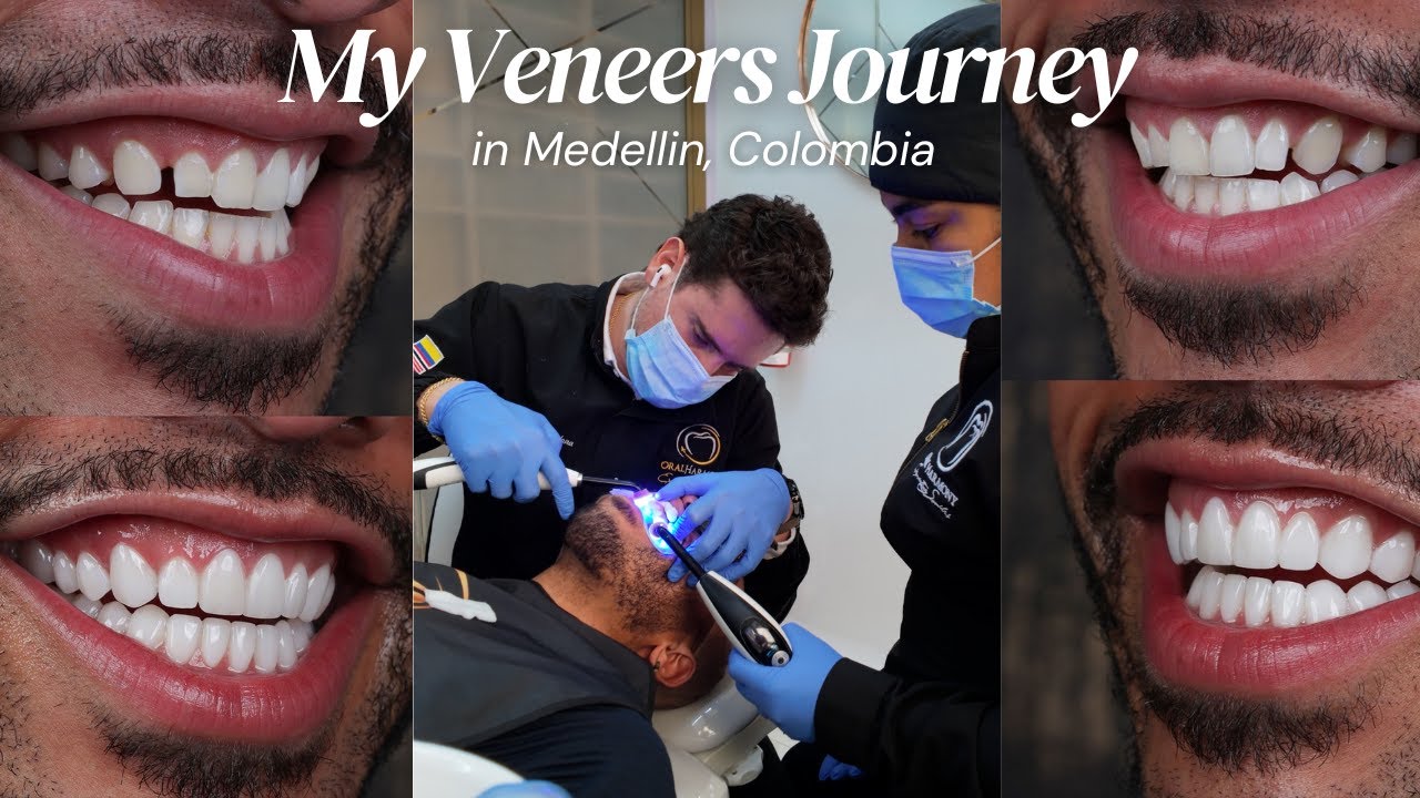 Мой путь к винирам в Медельине, Колумбия: правда о стоматологическом туризме (видеоблог) | Oral H...