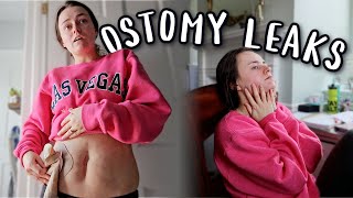 I'm Over These Leaks So I'm Ordering Different Ostomy Supplies! | Let's Talk IBD