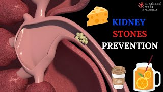 How To Prevent Kidney Stones - Natural Remedies