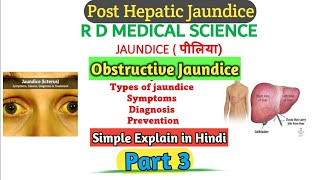Jaundice in Hindi|Post Hepatic jaundice|Sing & symptoms of jaundice |Obstructive jaundice|Diagnosis