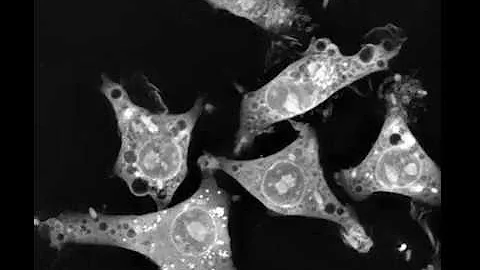 Macrophages from mice engulfing E. coli