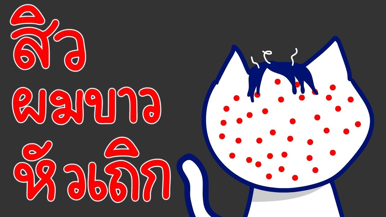 เป็นสิว หัวเถิก ผมขาว