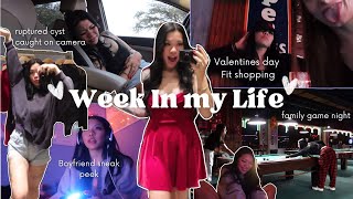 WEEK IN MY LIFE ♡ Valentine’s Day Shopping, Ruptured Cyst, Boyfriend appearance &amp; family game night!