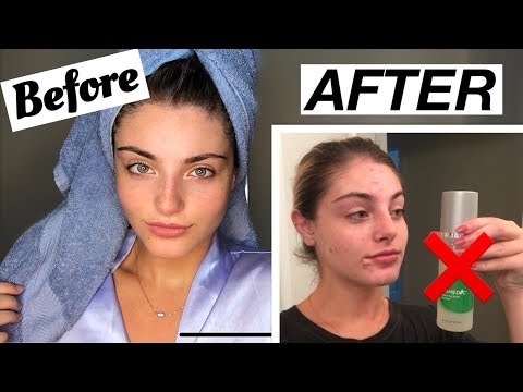 I DIDN&#;T WASH MY FACE FOR A MONTH STRAIGHT...and this is what happened (acne journey)
