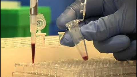 Temporal Study of Viral Gene Expression and Vaccinia Virus Infection: Part 3