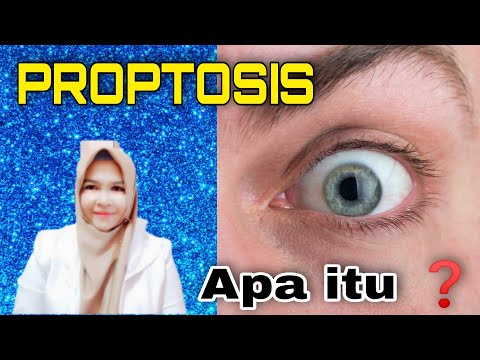 Video: Bagaimana untuk membetulkan proptosis?