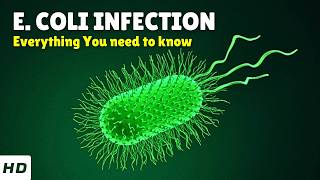E. Coli Infection Causes, Signs And Symptoms, Diagnosis & Treatment