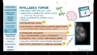 Benign breast conditions : pathology review | Osmosis