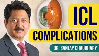 Dr. Sanjay Chaudhary | i - Talk | ICL Complications | ICL Eye Surgery