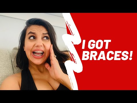 Vlog: I Got Braces! And can’t talk!!!