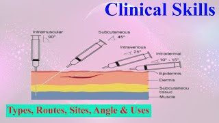 Complete guide to injection types & Technique || Routes & Angles #clinicaltrials  #skills