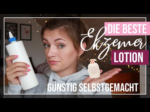 Video: Hilft Galmei-Lotion bei Sonnenbrand?