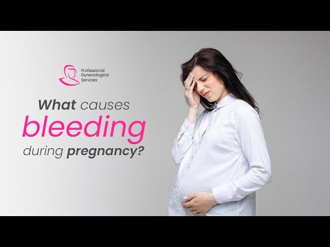 Video: În timpul sarcinii, motiv de sângerare?
