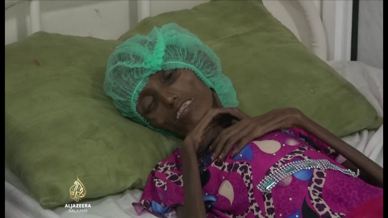 ملايين الجياع في اليمن بحاجة ماسة إلى المساعدة