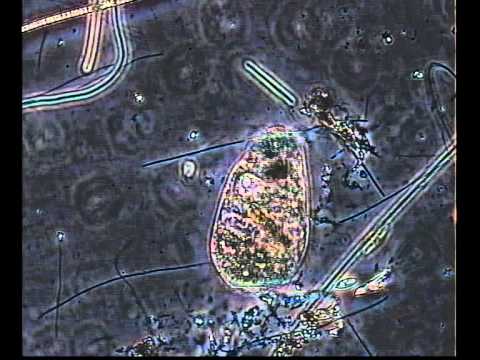 ENCHELYODON? CILIADO MARINO-MARINE CILIATE bacterial transformation