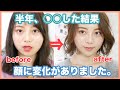 【小顔】半年○○した結果。。輪郭.顔の歪みに変化が♡!