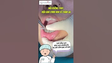Thun Chuỗi Trong Niềng Răng Có Tác Dụng Gì? | Nha Khoa MARINA #nhakhoamarina #dentist #dentalclinic