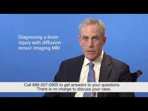 Diagnosing a Brain Injury with Diffusion Tensor Imaging MRI