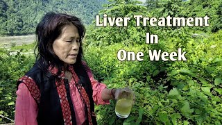 Liver Problemcure In One Weekherbal And Chemical Free Treatmentpasighat