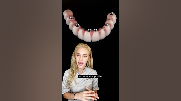Prótesis Híbrida. Una alternativa cómoda, natural y económica #shorts #dentista #protesisdental