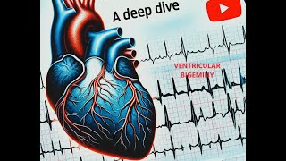 Ventricular Bigeminy Uncovered: ECG Analysis and Emergency Management Strategies