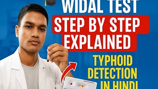 HOW TO PERFORM WIDAL TEST|| TYPHOID EXPLANATION#viral #bmlt_lecture #dmlt 