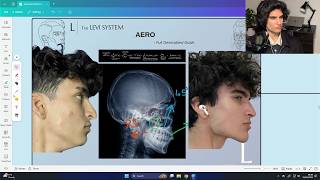 Download lagu How AERO improves your appearance (Full Guide)
