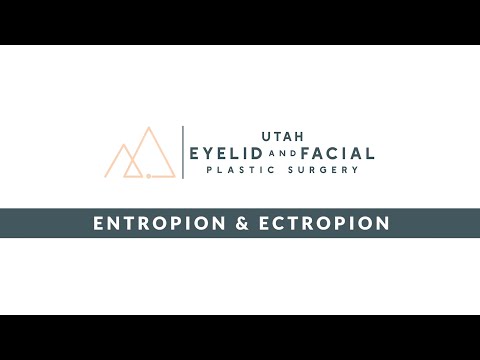 Ectropion, Entropion & Eyelid Retraction