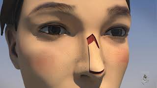 Chirurgie Dermatologique