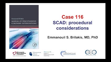 Case 116: PCI Manual - SCAD PCI troubleshooting