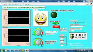 EMG Biofeedback System for Muscle Rehabilitation