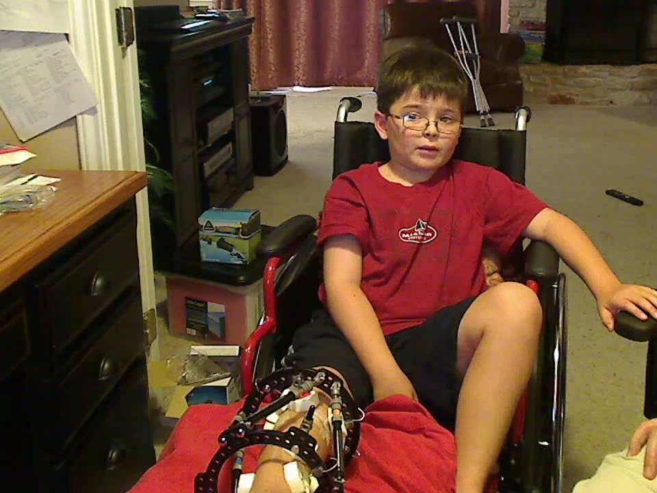 Ben at home five days after surgery YouTube