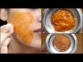 I applied VITAMIN C on my Face & Look What Happened - Benefits of Vitamin C for our skin