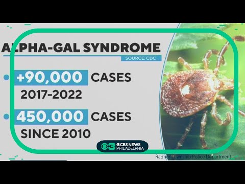 Up to 450,000 in U.S. have red meat allergies due to alpha-gal syndrome spread by ticks, CDC says