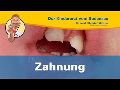 Video: Wie Man Einem Kind Hilft, Wenn Die Zähne Zahnen