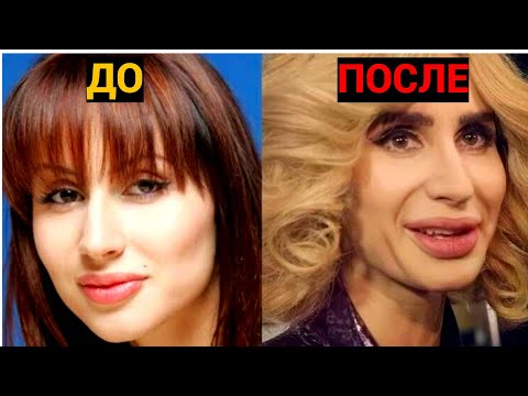 ЧТО ЗА МОРДА? Российские звезды, которые пожалели о неудачной пластике!